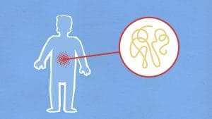 Gastro Pain due to lack of Vitamins in body 